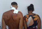 Mãe e padrasto são presos por suspeita de espancar criança de dois anos na BA; vítima tinha olhos roxos e queimaduras de cigarro