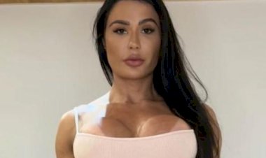 Gracyanne Barbosa mostra mudanças no corpo após cirurgia